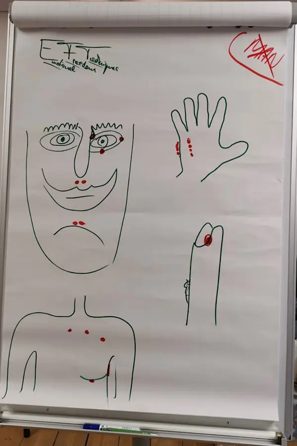 Flipchart-Zeichnung mit stilisierten Körperteilen und markierten EFT-Klopfpunkten an Gesicht, Oberkörper, Hand und Finger. Beschriftung: Emotional Freedom Techniques.